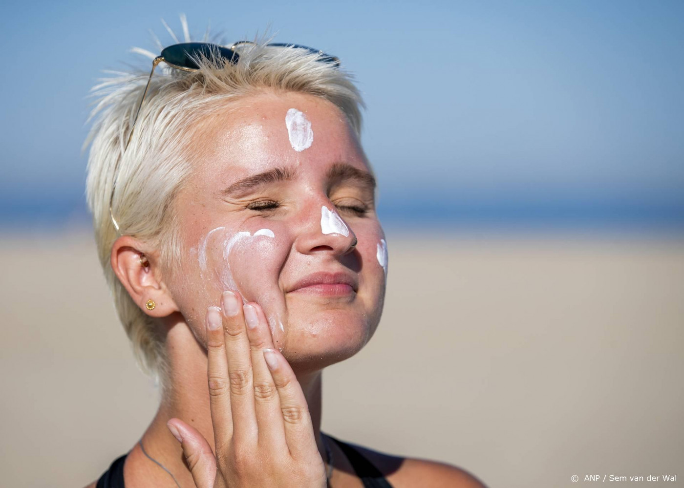 AI kan melanomen net zo goed herkennen als huidartsen