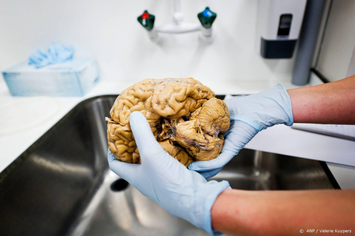 ‘Neurowetenschap kan AI beschermen tegen cyberaanvallen’